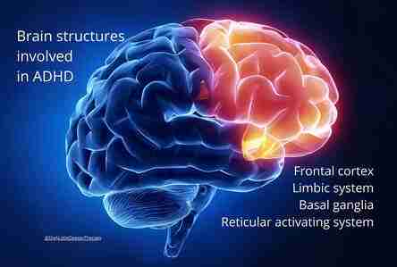 ADHD Couples: Solutions Beyond Traditional Therapy 3 Image of a brain, depicting different regions involved in ADHD